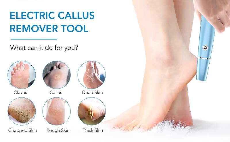 Elektrischer Hornhautentferner für die Füße⚡/Electric Feet Callus Remover⚡