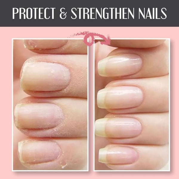 ⭐Nagelreparatur-Schutzgel❤️
