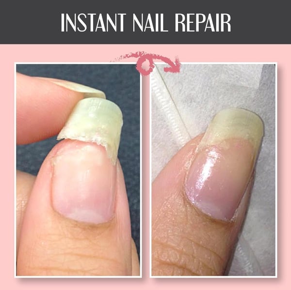 ⭐Nagelreparatur-Schutzgel❤️